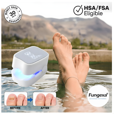 Fungexa™ - Nail Fungus Laser Device