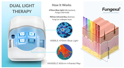 Fungexa™ - Nail Fungus Laser Device