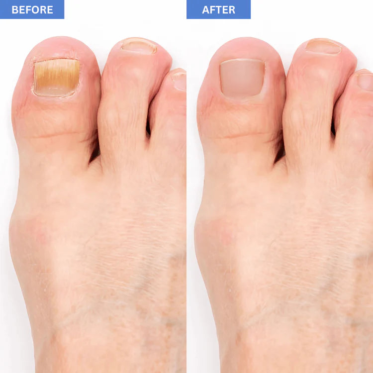 Clear Nails Are Possible -